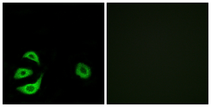 ACOT8 Antibody - Immunofluorescence analysis of A549 cells, using ACOT8 Antibody. The picture on the right is blocked with the synthesized peptide.