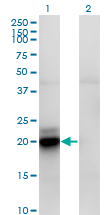 ACOT9 Antibody - Western blot of ACOT9 expression in transfected 293T cell line by ACATE2 monoclonal antibody, clone 4E4.