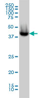ACOT9 Antibody - ACATE2 monoclonal antibody, clone 4E4 Western blot of ACATE2 expression in MCF-7.