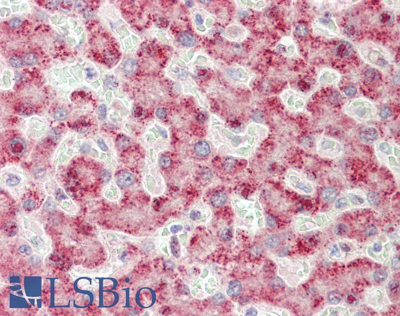 ACOX1 / ACOX Antibody - Anti-ACOX1 / ACOX antibody IHC staining of human liver. Immunohistochemistry of formalin-fixed, paraffin-embedded tissue after heat-induced antigen retrieval. Antibody dilution 1:50.
