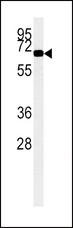 ACOX1 / ACOX Antibody - ACOX1 Monoclonal Antibody western blot of K562 cell line lysates (15 ug/lane). The ACOX1 antibody detected the ACOX1 protein (arrow). (1 ug/ml)1:390