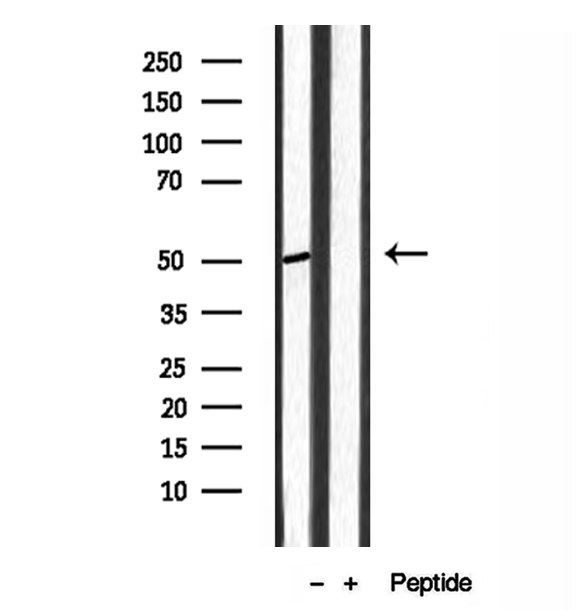 ACOX1 / ACOX Antibody - Western blot analysis of extracts of mouse liver tissue using ACOX1 antibody.