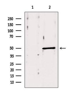 ACOX1 / ACOX Antibody - Western blot analysis of extracts of mouse brain tissue using ACOX1 antibody. Lane 1 was treated with the blocking peptide.