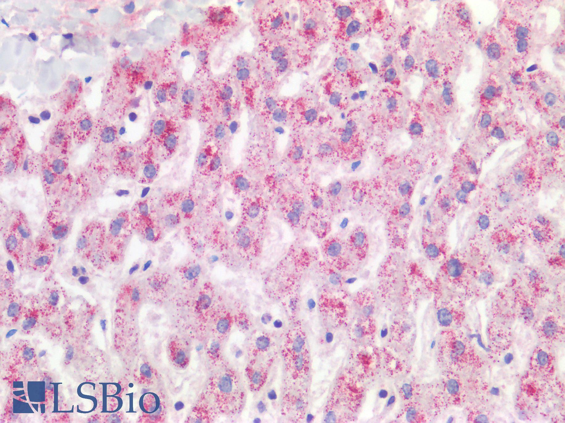 ACOX1 / ACOX Antibody - Human Liver: Formalin-Fixed, Paraffin-Embedded (FFPE)