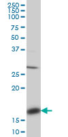 ACP1 / Acid Phosphatase Antibody - ACP1 monoclonal antibody (M01), clone 4B10. Western Blot analysis of ACP1 expression in HeLa.