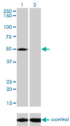 ACP2 / Acid Phosphatase 2 Antibody - Western blot of ACP2 over-expressed 293 cell line, cotransfected with ACP2 Validated Chimera RNAi (Lane 2) or non-transfected control (Lane 1). Blot probed with ACP2 monoclonal antibody, clone M1-4A12. GAPDH ( 36.1 kD ) used as specificity and loading control.