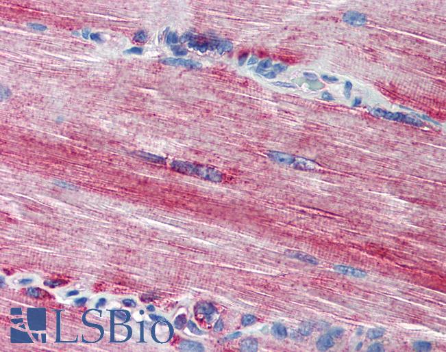 ACSL3 Antibody - Anti-ACSL3 antibody IHC of human skeletal muscle. Immunohistochemistry of formalin-fixed, paraffin-embedded tissue after heat-induced antigen retrieval. Antibody concentration 20 ug/ml.