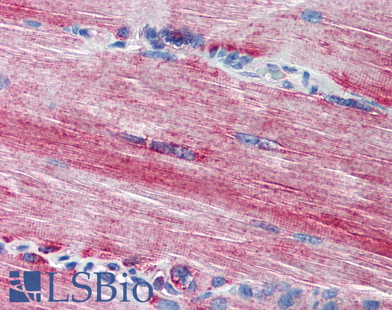 ACSL3 Antibody - Anti-ACSL3 antibody IHC of human skeletal muscle. Immunohistochemistry of formalin-fixed, paraffin-embedded tissue after heat-induced antigen retrieval. Antibody concentration 20 ug/ml.