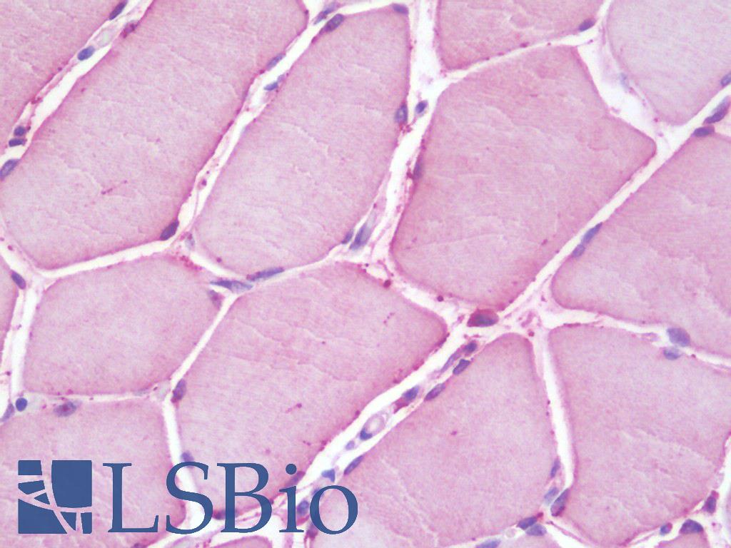 ACSL6 Antibody - Anti-ACSL6 antibody IHC staining of human skeletal muscle. Immunohistochemistry of formalin-fixed, paraffin-embedded tissue after heat-induced antigen retrieval. Antibody dilution 1:100.