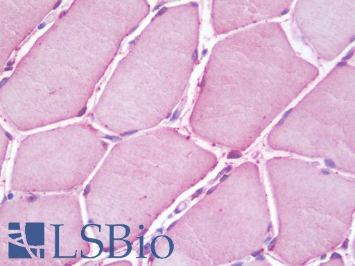 ACSL6 Antibody - Anti-ACSL6 antibody IHC staining of human skeletal muscle. Immunohistochemistry of formalin-fixed, paraffin-embedded tissue after heat-induced antigen retrieval. Antibody dilution 1:100.
