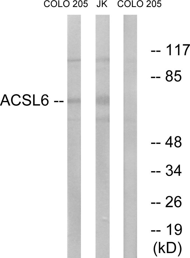 ACSL6 Antibody - Western blot analysis of lysates from COLO and Jurkat cells, using ACSL6 Antibody. The lane on the right is blocked with the synthesized peptide.