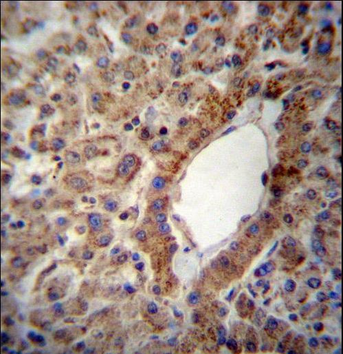 ACSS2 / ACAS2 Antibody - ACSS2 Antibody immunohistochemistry of formalin-fixed and paraffin-embedded human liver tissue followed by peroxidase-conjugated secondary antibody and DAB staining.