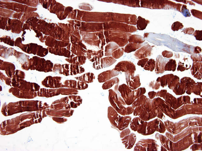 ACTA1 / Skeletal Muscle Actin Antibody - Paraffin sections of human striated skeletal muscle immunostained with 3B3 (1:250)