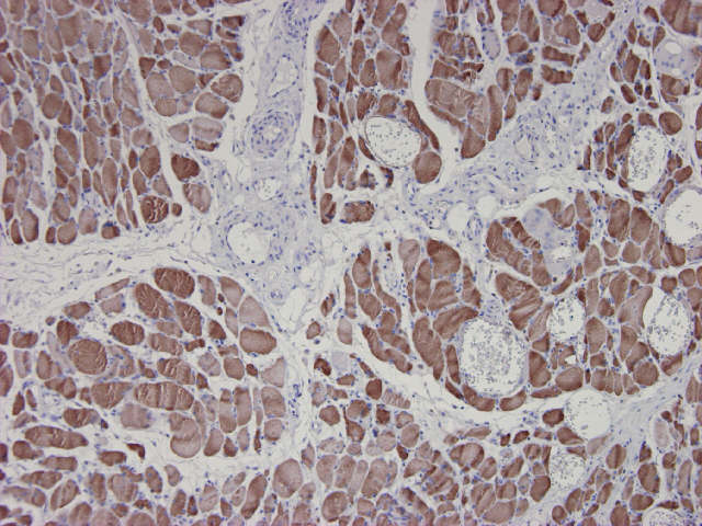 ACTA1 / Skeletal Muscle Actin Antibody - Paraffin sections of striated muscle (below) from human tongue immunostained with 3B3 (1:250)