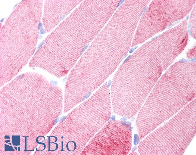 ACTA1 / Skeletal Muscle Actin Antibody - Anti-ACTA1 / ASMA antibody IHC of human skeletal muscle. Immunohistochemistry of formalin-fixed, paraffin-embedded tissue after heat-induced antigen retrieval. Antibody concentration 10 ug/ml.