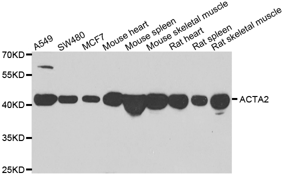 ACTA2 / Smooth Muscle Actin Antibody - Western blot analysis of extracts of various cell lines.