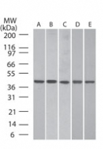 ACTB / Beta Actin Antibody - Western blot of beta actin in A: human brain (40141), B: mouse brain (40121), C: rat brain (40121), D: human lung (40146) and E: human spleen (40149)tissue lysates using antibody at 0.25 ug/ml.