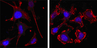 ACTB / Beta Actin Antibody - Confocal immunofluorescence of SKBR-3 (left) and A549 (right) cells using beta Actin mouse monoclonal antibody (red, the secondary Ab is Cy3-Goat anti mouse IgG). Blue: DRAQ5 fluorescent DNA dye.