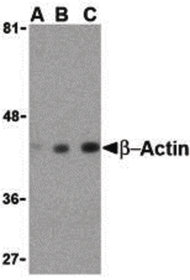 ACTB / Beta Actin Antibody - Western blot of beta-actin in HeLa cell lysate with beta-actin antibody at (A) 0.5, (B) 1 and (C) 2 ug/ml.