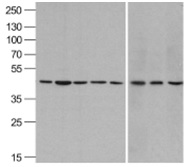 ACTB / Beta Actin Antibody - Western blot analysis of beta-actin in A431, Daudi, HepG2, HL60, Jurkat, Human brain, Mouse lung, and Chicken liver lysate with beta-actin antibody at 1ug/ml.
