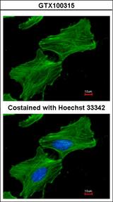 ACTB / Beta Actin Antibody - Immunofluorescence of methanol-fixed HeLa, using Beta actin antibody at 1:300 dilution.