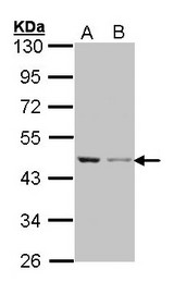 ACTB / Beta Actin Antibody - Sample (30 ug of whole cell lysate). A: A431. B: H1299. 10% SDS PAGE. ACTB antibody diluted at 1:1000. 
