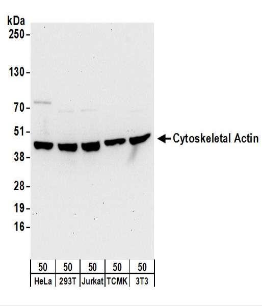 ACTB / Beta Actin Antibody - Detection of Human and Mouse Cytoskeletal Actin by Western Blot. Samples: Whole cell lysate (50 ug) from HeLa, 293T, Jurkat, mouse TCMK-1, and mouse NIH3T3 cells. Antibodies: Affinity purified rabbit anti-Cytoskeletal Actin antibody used for WB at 0.1 ug/ml. Detection: Chemiluminescence with an exposure time of 30 seconds.