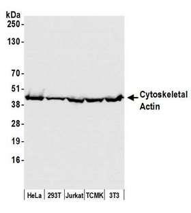 ACTB / Beta Actin Antibody - Detection of human and mouse Cytoskeletal Actin by western blot. Samples: Whole cell lysate (50 µg) from HeLa, HEK293T, Jurkat, mouse TCMK-1, and mouse NIH 3T3 cells prepared using NETN lysis buffer. Antibody: Affinity purified rabbit anti-Cytoskeletal Actin antibody used for WB at 0.1 µg/ml. Detection: Chemiluminescence with an exposure time of 1 second.