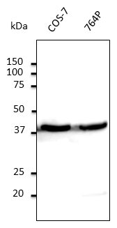ACTB / Beta Actin Antibody - Anti-beta-Actin Ab at 1:500 dilution; lysates at 100 ug per lane; Rabbit polyclonal to goat IgG (HRP) at 1:10,000 dilution;