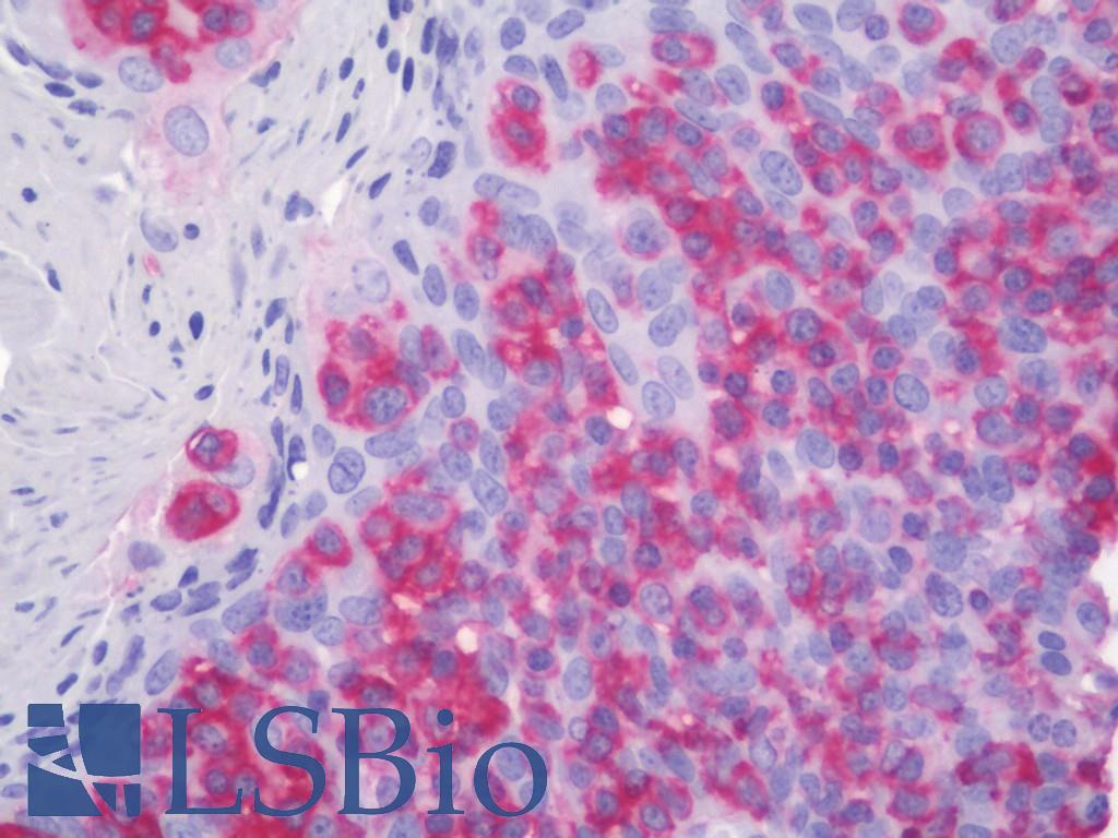 ACTBL2 Antibody - Anti-ACTBL2 antibody IHC staining of human tonsil. Immunohistochemistry of formalin-fixed, paraffin-embedded tissue after heat-induced antigen retrieval. Antibody dilution 1:100.