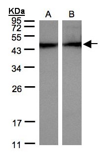ACTC1 / Alpha Cardiac Actin Antibody - Sample (30 ug of whole cell lysate). A: HeLa S3, B: MOLT4. 12% SDS PAGE. ACTC1 / Alpha-Cardiac Actin antibody diluted at 1:500