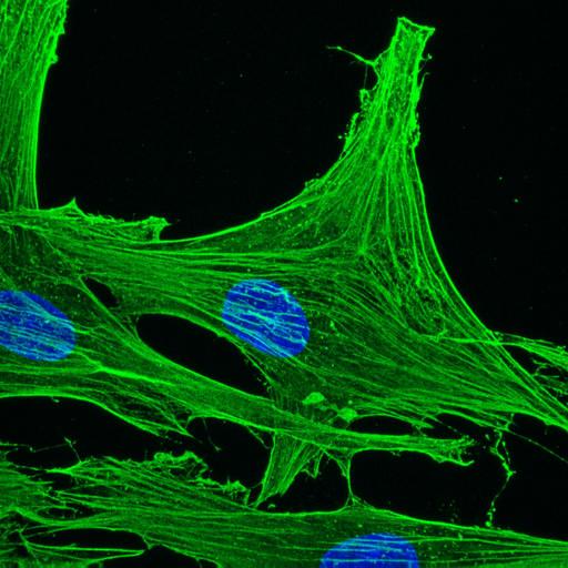 ACTG1 / Gamma Actin Antibody - Methanol fixed human dermal fibroblasts immunostained with 2A3 (1:500)