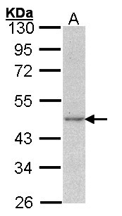 ACTG1 / Gamma Actin Antibody - Sample (30 ug of whole cell lysate). A: A431. 10% SDS PAGE. ACTG1 antibody diluted at 1:1000. 