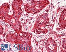 ACTG1 / Gamma Actin Antibody - Anti-ACTG1 / Gamma Actin antibody IHC staining of human breast. Immunohistochemistry of formalin-fixed, paraffin-embedded tissue after heat-induced antigen retrieval. Antibody concentration 10 ug/ml.