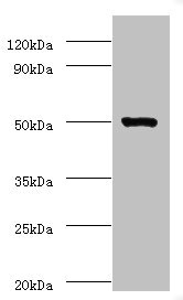 ACTL7A Antibody - Western blot All lanes: Actin-like protein 7A antibody at 2µg/ml + Mouse liver tissue Secondary Goat polyclonal to rabbit IgG at 1/10000 dilution Predicted band size: 49 kDa Observed band size: 49 kDa