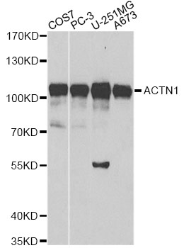 ACTN1 Antibody - Western blot analysis of extracts of various cell lines, using ACTN1 antibody at 1:500 dilution. The secondary antibody used was an HRP Goat Anti-Rabbit IgG (H+L) at 1:10000 dilution. Lysates were loaded 25ug per lane and 3% nonfat dry milk in TBST was used for blocking.