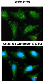 ACTN2 Antibody - Immunofluorescence of methanol-fixed HeLa, using alpha Actinin 2 antibody at 1:200 dilution.