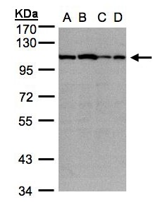 ACTN2 Antibody - Sample(30 ug whole cell lysate). A: A431. B: H1299. C: HeLa S3. D: Hep G2. 7.5% SDS PAGE. ACTN2 antibody diluted at 1:1000.