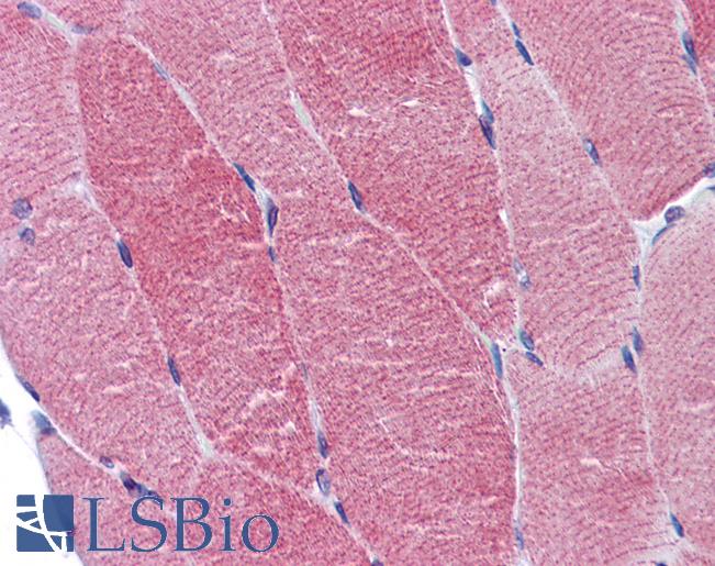 ACTN2 Antibody - Anti-ACTN2 antibody IHC of human skeletal muscle. Immunohistochemistry of formalin-fixed, paraffin-embedded tissue after heat-induced antigen retrieval. Antibody concentration 10 ug/ml.