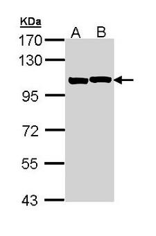 ACTN2 Antibody - Sample (30 ug of whole cell lysate). A: A431. B: H1299. 7.5% SDS PAGE. ACTN2 antibody diluted at 1:1000. 