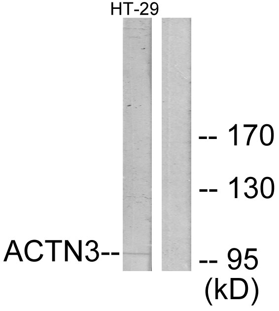 ACTN3 Antibody - Western blot analysis of lysates from HT-29 cells, using ACTN3 Antibody. The lane on the right is blocked with the synthesized peptide.