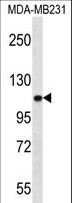 ACTN3 Antibody - ACTN3 Antibody western blot of MDA-MB231 cell line lysates (35 ug/lane). The ACTN3 antibody detected the ACTN3 protein (arrow).