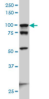 ACTN4 Antibody - ACTN4 monoclonal antibody (M01), clone 4D10 Western blot of ACTN4 expression in HeLa NE.