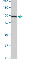 ACTN4 Antibody - ACTN4 monoclonal antibody (M01), clone 4D10. Western blot of ACTN4 expression in MCF-7.