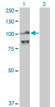 ACTN4 Antibody - Western blot of ACTN4 expression in transfected 293T cell line by ACTN4 monoclonal antibody (M01), clone 4D10.