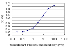 ACTN4 Antibody - Detection limit for recombinant GST tagged ACTN4 is approximately 0.1 ng/ml as a capture antibody.