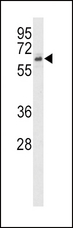 ACTRIIB / ACVR2B Antibody - Western blot of ACVR2B in Jurkat cell line lysates (35 ug/lane). ACVR2B (arrow) was detected using the purified antibody.