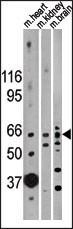 ACTRIIB / ACVR2B Antibody - Western blot of anti-ACVR2B Antibody in mouse heart, kidney and brain lysates (35 ug/lane). ACVR2B (arrow) was detected using the purified antibody.