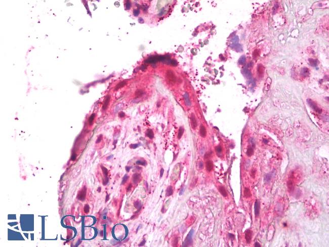 ACTRIIB / ACVR2B Antibody - Anti-ACTRIIB / ACVR2B antibody IHC of human placenta, trophoblast. Immunohistochemistry of formalin-fixed, paraffin-embedded tissue after heat-induced antigen retrieval. Antibody dilution 10 ug/ml.