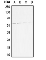 ACVR1B / ALK4 Antibody - Western blot analysis of ACVR1B expression in HeLa (A); Jurkat (B); SP2/0 (C); H9C2 (D) whole cell lysates.